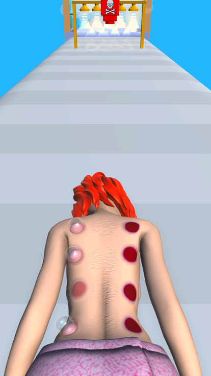 Cupping Treatment游戏截图