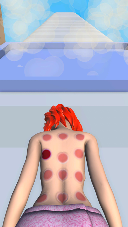 Cupping Treatment游戏截图