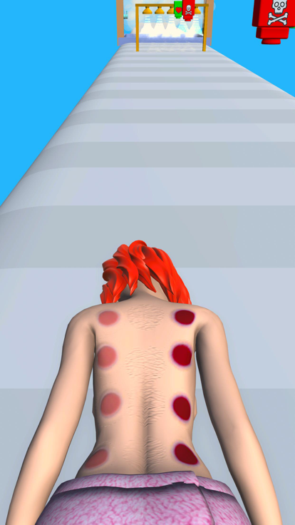 Cupping Treatment游戏截图